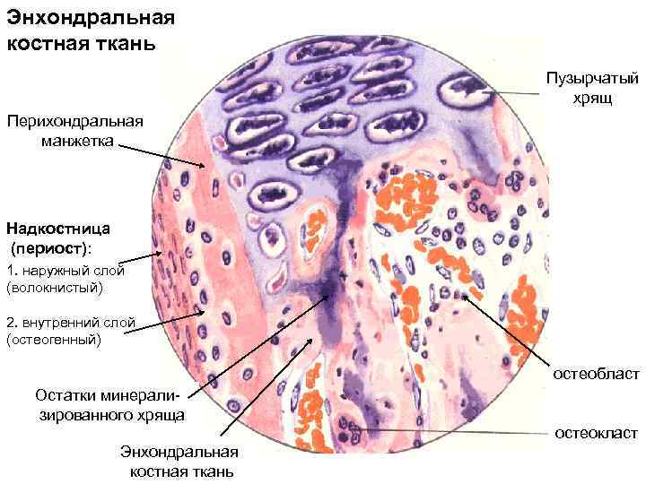 Строение опухоли картинка