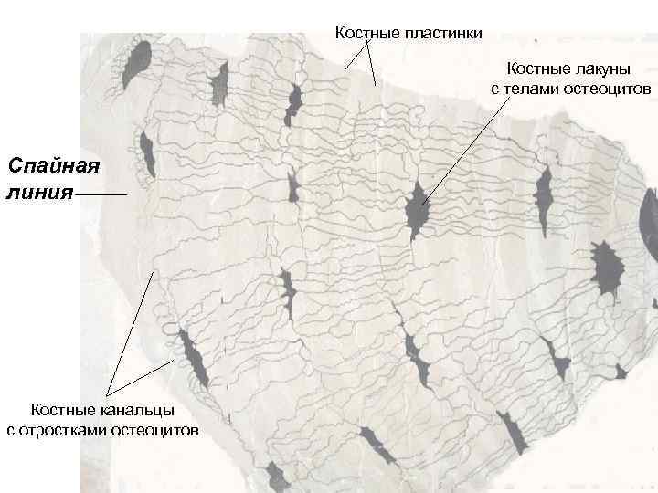 Костные пластинки Костные лакуны с телами остеоцитов Спайная линия Костные канальцы с отростками остеоцитов
