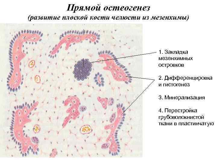 Прямой остеогенез схема