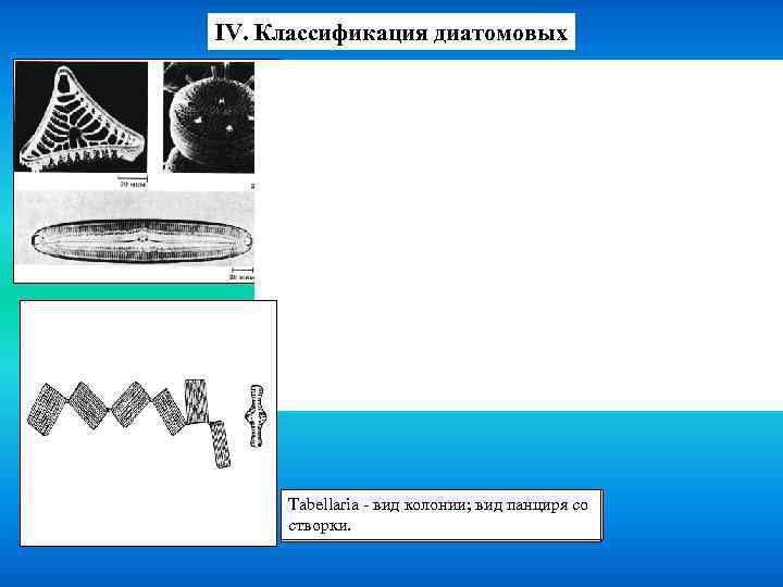IV. Классификация диатомовых Tabellaria вид со клетка панциря со Gomphonema вид колони; вид исо