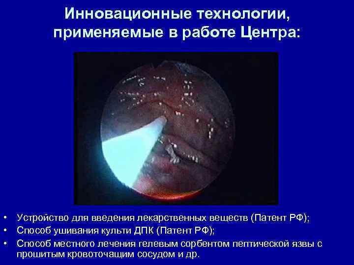 Инновационные технологии, применяемые в работе Центра: • Устройство для введения лекарственных веществ (Патент РФ);