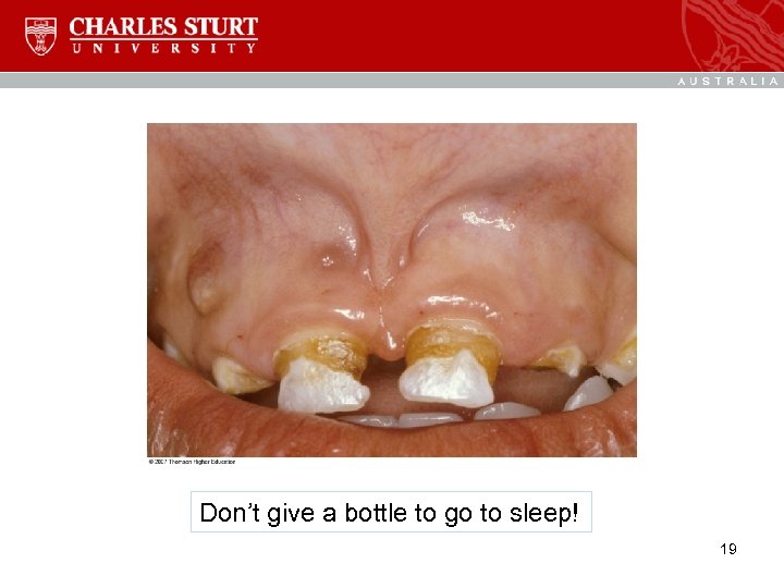 Don’t give a bottle to go to sleep! 19 