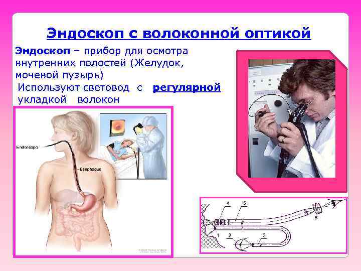 Эндоскоп с волоконной оптикой Эндоскоп – прибор для осмотра внутренних полостей (Желудок, мочевой пузырь)