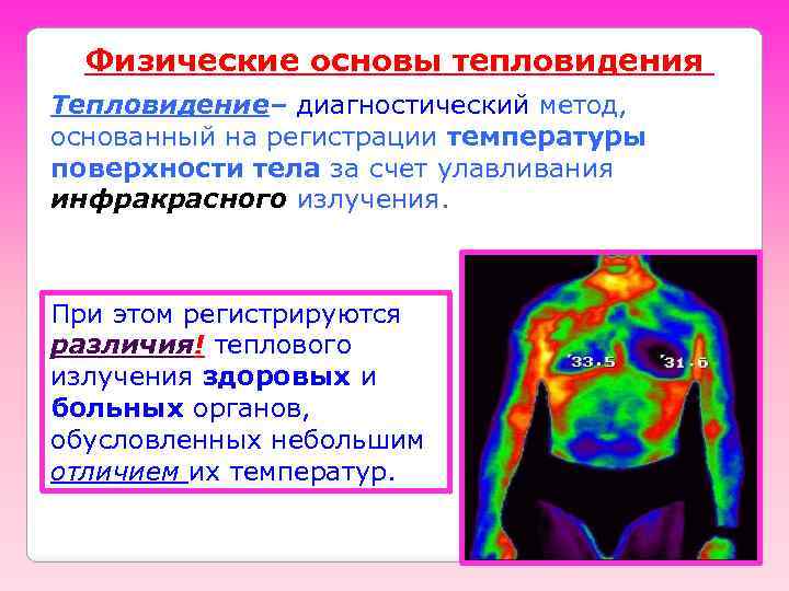 Физические основы тепловидения Тепловидение– диагностический метод, основанный на регистрации температуры поверхности тела за счет