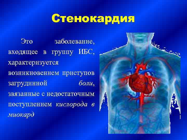 Стенокардия Это заболевание, входящее в группу ИБС, характеризуется возникновением приступов загрудинной боли, звязанные с