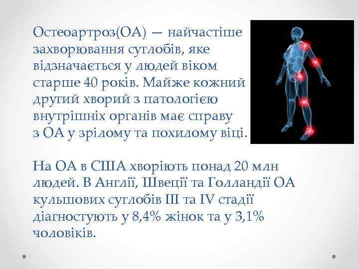 Остеоартроз(ОА) — найчастіше захворювання суглобів, яке відзначається у людей віком старше 40 років. Майже