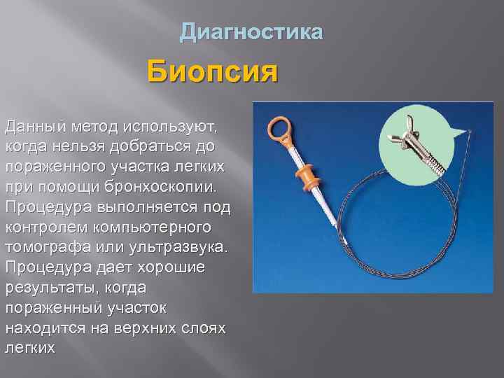 Диагностика Биопсия Данный метод используют, когда нельзя добраться до пораженного участка легких при помощи