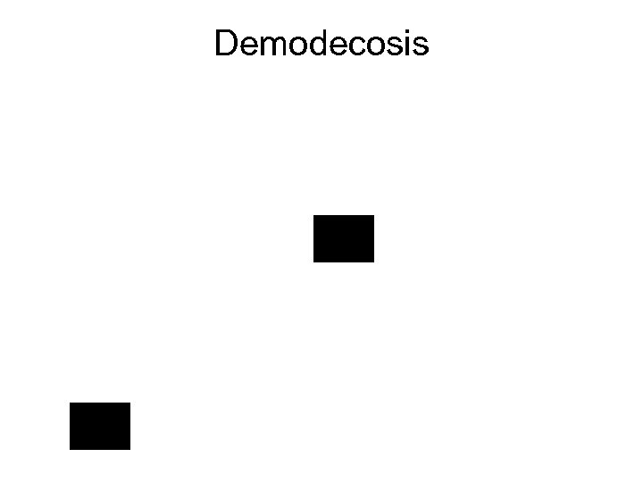 Demodecosis 