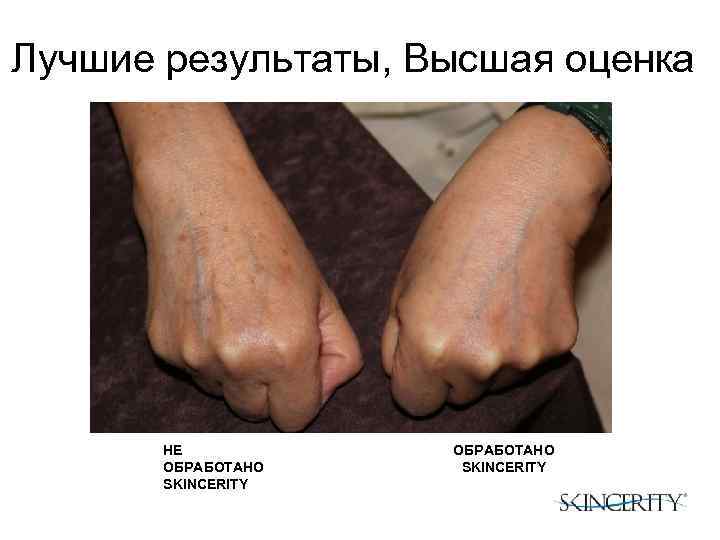 Лучшие результаты, Высшая оценка НE ОБРАБОТАНО SKINCERITY 