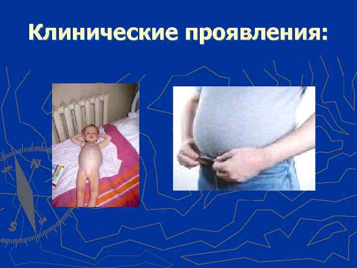 Клинические проявления: 