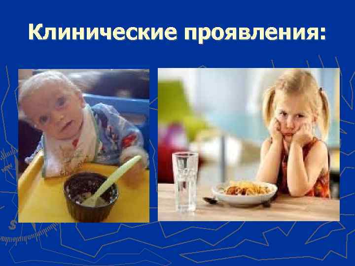 Клинические проявления: 