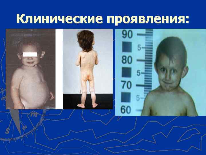 Клинические проявления: 