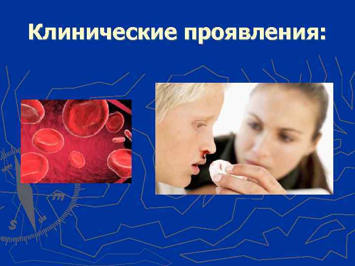 Клинические проявления: 