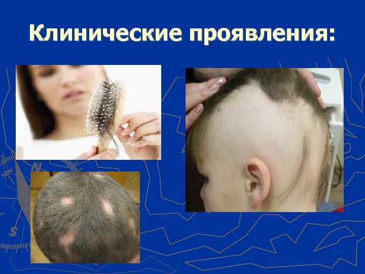 Клинические проявления: 