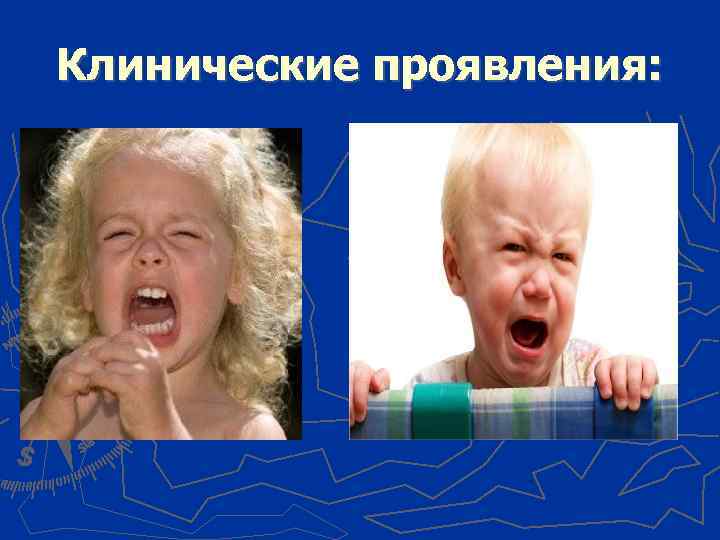 Клинические проявления: 