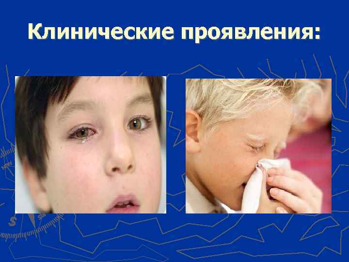 Клинические проявления: 