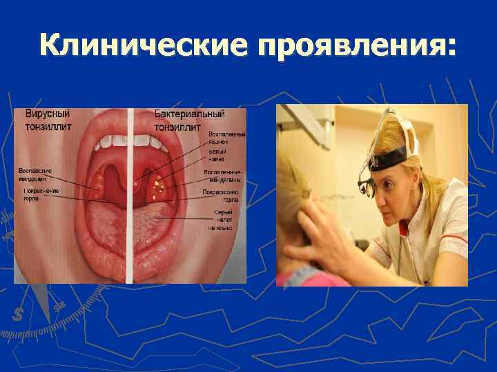 Клинические проявления: 