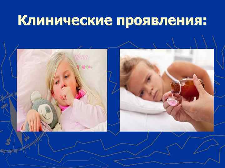 Клинические проявления: 
