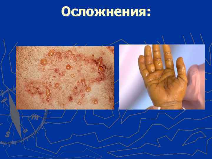 Осложнения: 