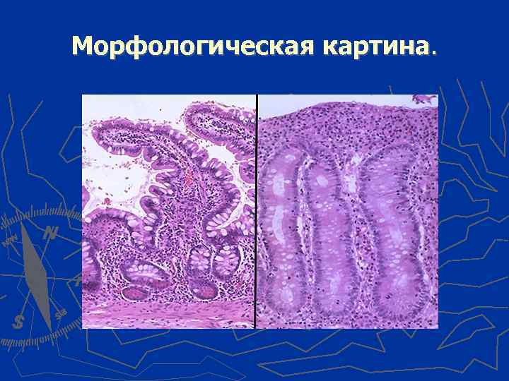 Морфологическая картина. 