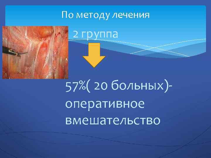 По методу лечения 2 группа 57%( 20 больных)оперативное вмешательство 