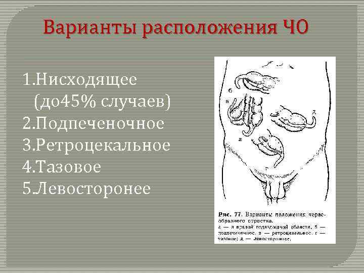  Варианты расположения ЧО 1. Нисходящее (до 45% случаев) 2. Подпеченочное 3. Ретроцекальное 4.
