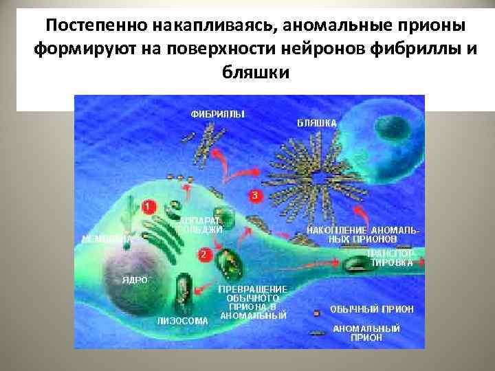 Постепенно накапливаясь, аномальные прионы формируют на поверхности нейронов фибриллы и бляшки 