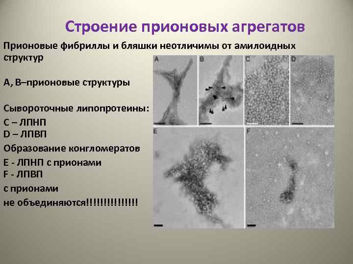 Строение прионовых агрегатов Прионовые фибриллы и бляшки неотличимы от амилоидных структур А, В–прионовые структуры