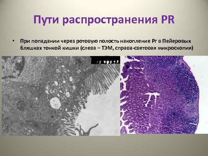 Пути распространения PR • При попадании через ротовую полость накопление Pr в Пейеровых бляшках