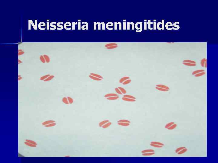 Neisseria meningitides 