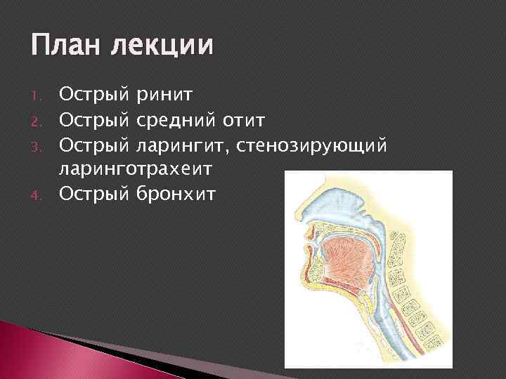 План лекции 1. 2. 3. 4. Острый ринит Острый средний отит Острый ларингит, стенозирующий