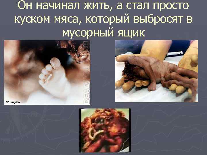 Он начинал жить, а стал просто куском мяса, который выбросят в мусорный ящик 