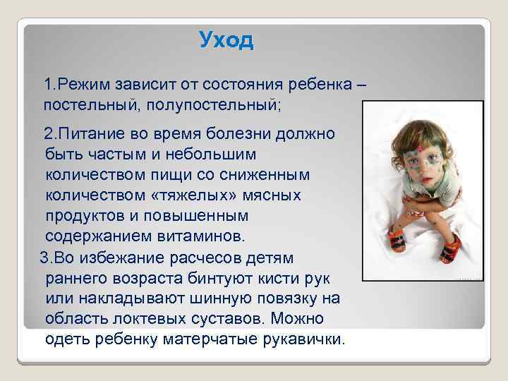 Уход 1. Режим зависит от состояния ребенка – постельный, полупостельный; 2. Питание во время