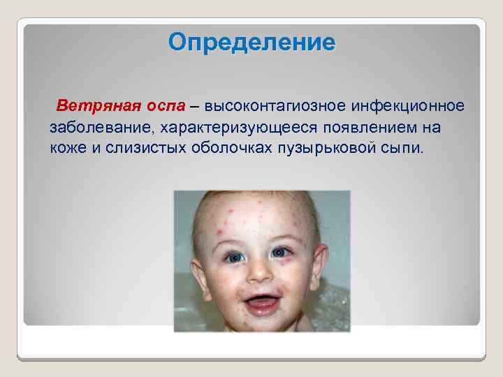 Определение Ветряная оспа – высоконтагиозное инфекционное заболевание, характеризующееся появлением на коже и слизистых оболочках
