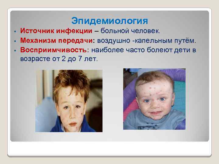 Эпидемиология Источник инфекции – больной человек. • Механизм передачи: воздушно -капельным путём. • Восприимчивость: