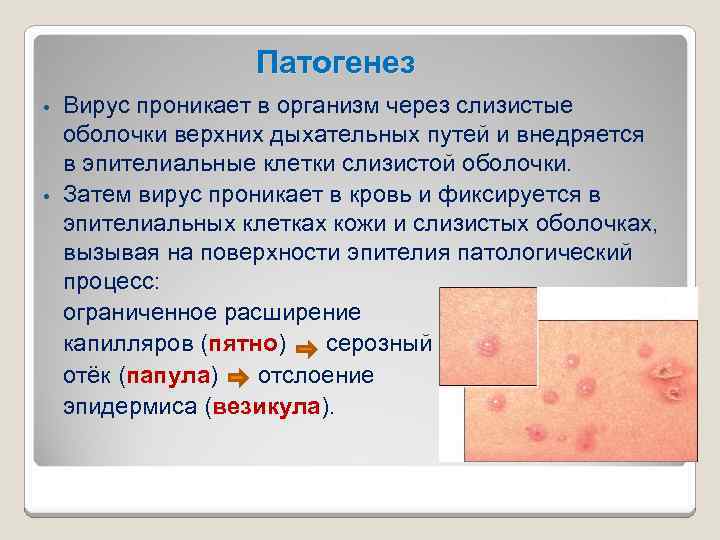 Патогенез Вирус проникает в организм через слизистые оболочки верхних дыхательных путей и внедряется в