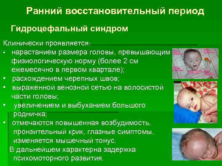 Ранний восстановительный период Гидроцефальный синдром Клинически проявляется: • нарастанием размера головы, превышающим физиологическую норму