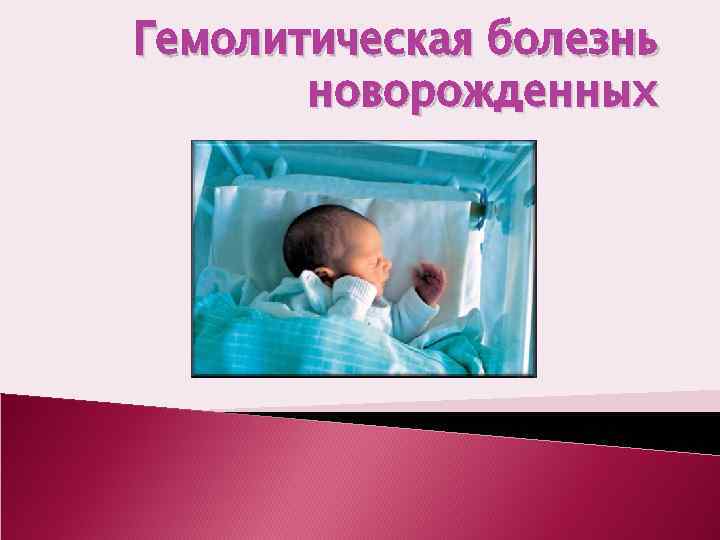 Гемолитическая болезнь новорожденных. ГБН У новорожденных презентация. Гемолитическая болезнь новорожденных презентация. Новорожденный для презентации. ГБН новорожденных лекция.