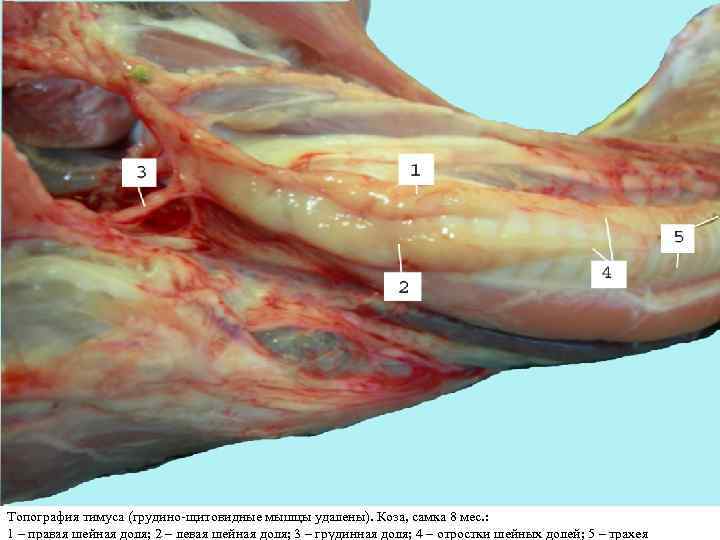 Топография тимуса (грудино-щитовидные мышцы удалены). Коза, самка 8 мес. : 1 – правая шейная