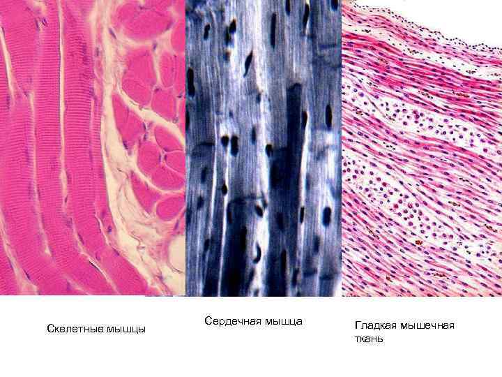 Скелетные мышцы Сердечная мышца Гладкая мышечная ткань 
