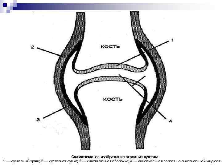 Рисунок сустава анатомия. Строение сустава. Схема строения сустава. Строение сустава рисунок. Общий план строения сустава.