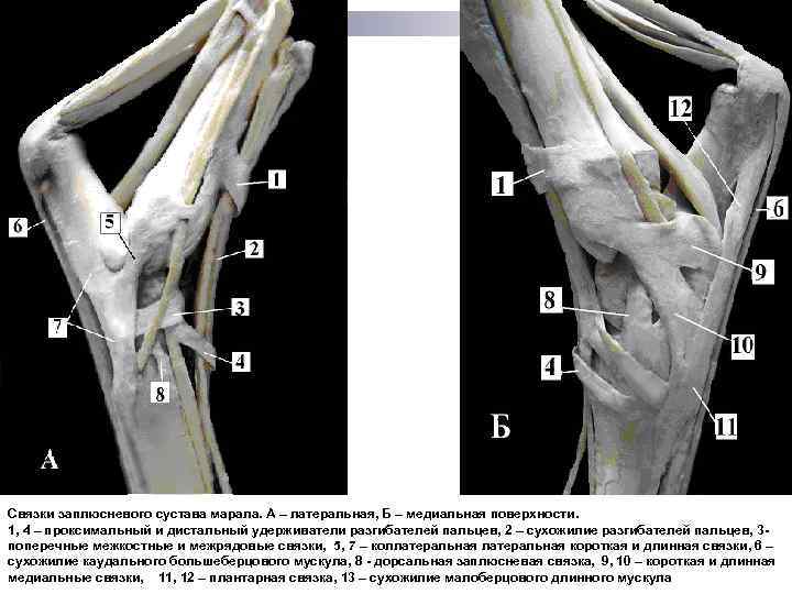 Связки заплюсневого сустава марала. А – латеральная, Б – медиальная поверхности. 1, 4 –
