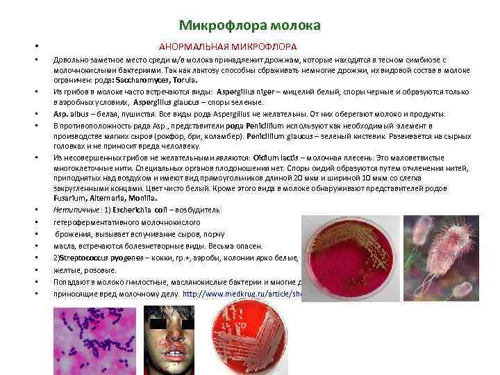 Микрофлора молока • АНОРМАЛЬНАЯ МИКРОФЛОРА • Довольно заметное место среди м/в молока принадлежит дрожжам,