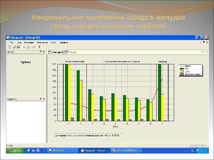 Неправильное положение зонда в желудке (зонд заведен слишком глубоко) 