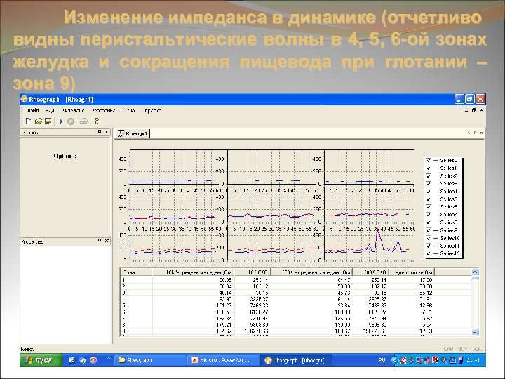 Изменение импеданса в динамике (отчетливо видны перистальтические волны в 4, 5, 6 -ой зонах