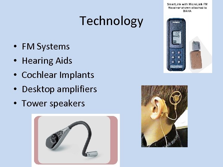 Technology • • • FM Systems Hearing Aids Cochlear Implants Desktop amplifiers Tower speakers