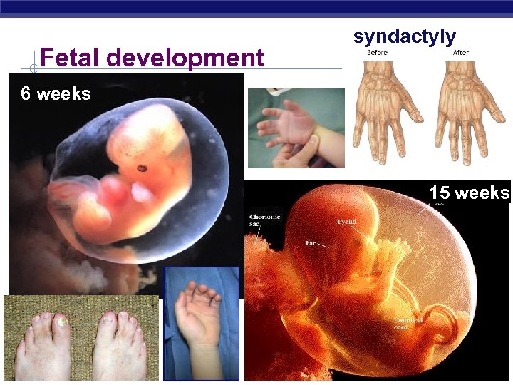 Fetal development syndactyly 6 weeks 15 weeks AP Biology 