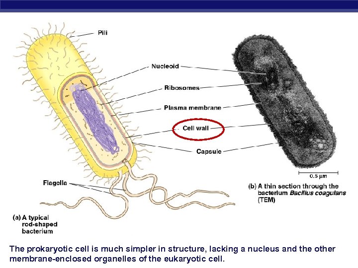 The prokaryotic cell is much simpler in structure, lacking a nucleus and the other