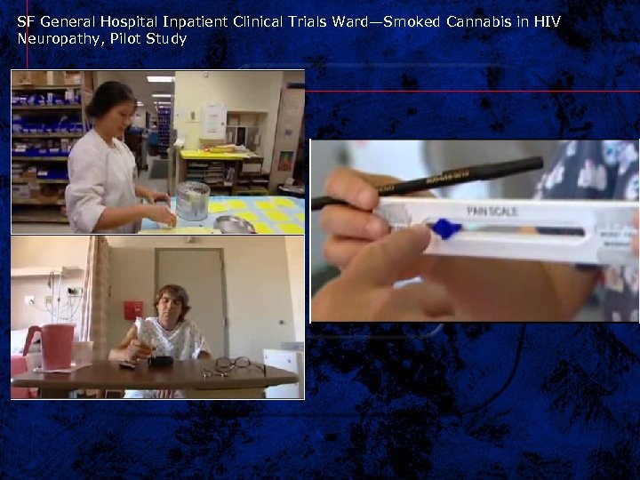 SF General Hospital Inpatient Clinical Trials Ward—Smoked Cannabis in HIV Neuropathy, Pilot Study 