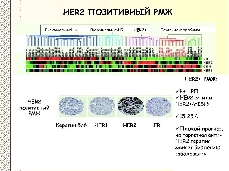HER 2 ПОЗИТИВНЫЙ РМЖ Люминальный А Люминальный Б HER 2+ Базально-подобный HER 2+ РМЖ: